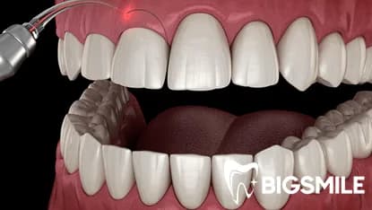 Periodontics (Gum Treatment)